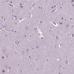 Carabin Antibody in Immunohistochemistry (Paraffin) (IHC (P))