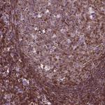 Carabin Antibody in Immunohistochemistry (Paraffin) (IHC (P))