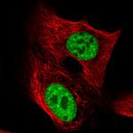 CA150 Polyclonal Antibody