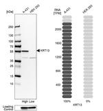 Cytokeratin 13 Antibody