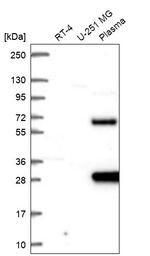SCHIP1 Antibody in Western Blot (WB)