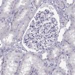 SGOL1 Antibody in Immunohistochemistry (Paraffin) (IHC (P))