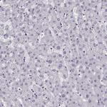 SGOL1 Antibody in Immunohistochemistry (Paraffin) (IHC (P))