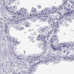 SGOL1 Antibody in Immunohistochemistry (Paraffin) (IHC (P))