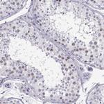 SGOL1 Polyclonal Antibody