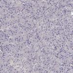 UROC1 Polyclonal Antibody