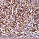 SEC23B Polyclonal Antibody