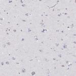 RGS19 Polyclonal Antibody