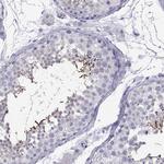 TTC18 Antibody in Immunohistochemistry (Paraffin) (IHC (P))