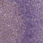 JAK3 Polyclonal Antibody