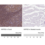 SHIP1 Antibody in Immunohistochemistry (Paraffin) (IHC (P))
