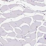 SHIP1 Antibody in Immunohistochemistry (Paraffin) (IHC (P))