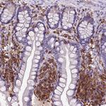 SHIP1 Antibody in Immunohistochemistry (Paraffin) (IHC (P))