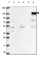 SHIP1 Antibody in Western Blot (WB)