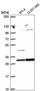 NORE1 Antibody in Western Blot (WB)