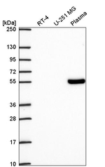TCF7 Antibody in Western Blot (WB)
