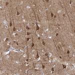 NECAB3 Polyclonal Antibody