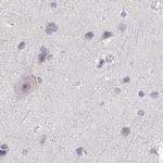 RUNDC3A Antibody in Immunohistochemistry (Paraffin) (IHC (P))