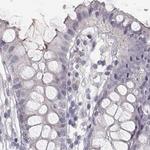 RUNDC3A Antibody in Immunohistochemistry (Paraffin) (IHC (P))