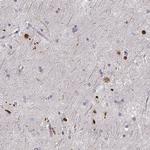 RUNDC3A Antibody in Immunohistochemistry (Paraffin) (IHC (P))