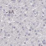 RUNDC3A Antibody in Immunohistochemistry (Paraffin) (IHC (P))