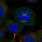 CKAP2L Antibody in Immunocytochemistry (ICC/IF)