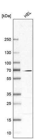 CKAP2L Antibody in Western Blot (WB)