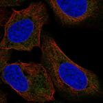 TTF2 Polyclonal Antibody