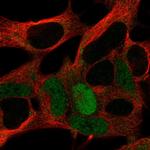 MAGEA10 Polyclonal Antibody