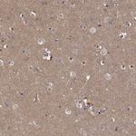 PEA15 Antibody in Immunohistochemistry (Paraffin) (IHC (P))