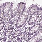 PEA15 Polyclonal Antibody