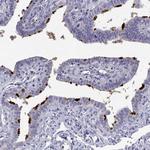 STOML3 Antibody in Immunohistochemistry (Paraffin) (IHC (P))