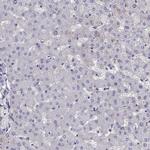 STOML3 Polyclonal Antibody