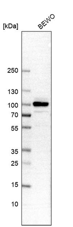 B-Raf Antibody in Western Blot (WB)