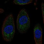 SLC3A1 Polyclonal Antibody
