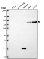 SLC3A1 Antibody in Western Blot (WB)