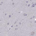 WFDC8 Antibody in Immunohistochemistry (Paraffin) (IHC (P))