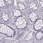 WFDC8 Antibody in Immunohistochemistry (Paraffin) (IHC (P))