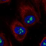 TMEM217 Polyclonal Antibody