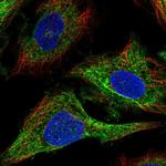 MRCK alpha Polyclonal Antibody