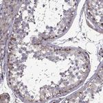 MRCK alpha Antibody in Immunohistochemistry (Paraffin) (IHC (P))