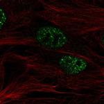 SMURF2 Polyclonal Antibody