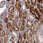 SMURF2 Antibody in Immunohistochemistry (Paraffin) (IHC (P))