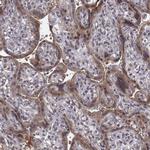 SMURF2 Antibody in Immunohistochemistry (Paraffin) (IHC (P))