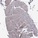 SMURF2 Antibody in Immunohistochemistry (Paraffin) (IHC (P))