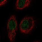 TNFRSF19L Polyclonal Antibody