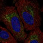 TMEM185A Polyclonal Antibody