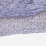 TRPS1 Polyclonal Antibody