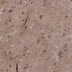 NECAB3 Antibody in Immunohistochemistry (Paraffin) (IHC (P))