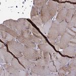 NECAB3 Antibody in Immunohistochemistry (Paraffin) (IHC (P))